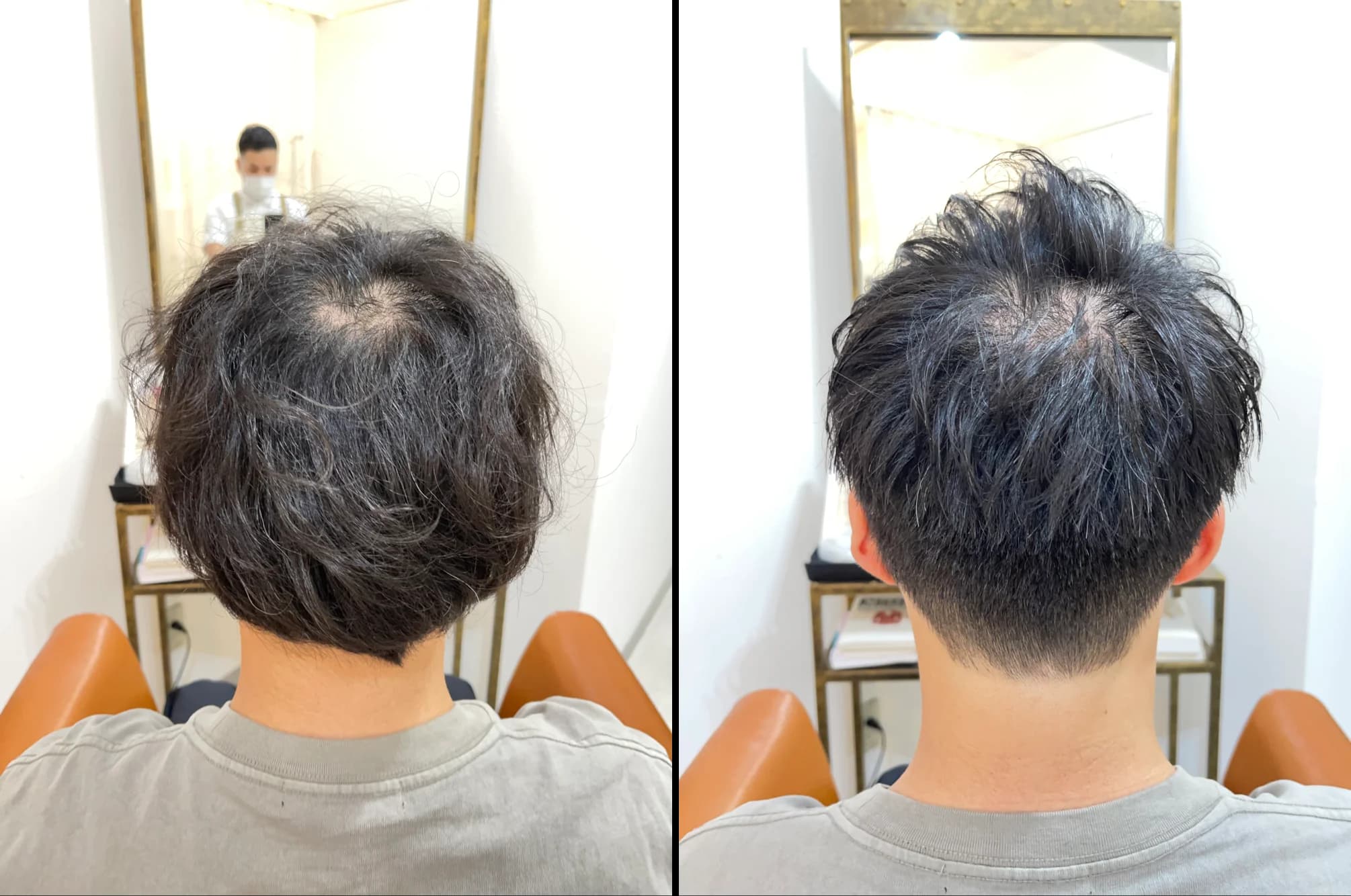 育毛促進ヘッドスパのビフォーアフター